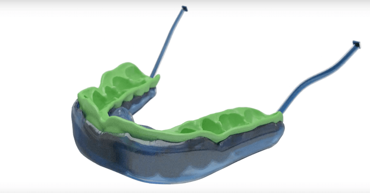 nusplint_thumbnail_mng_small